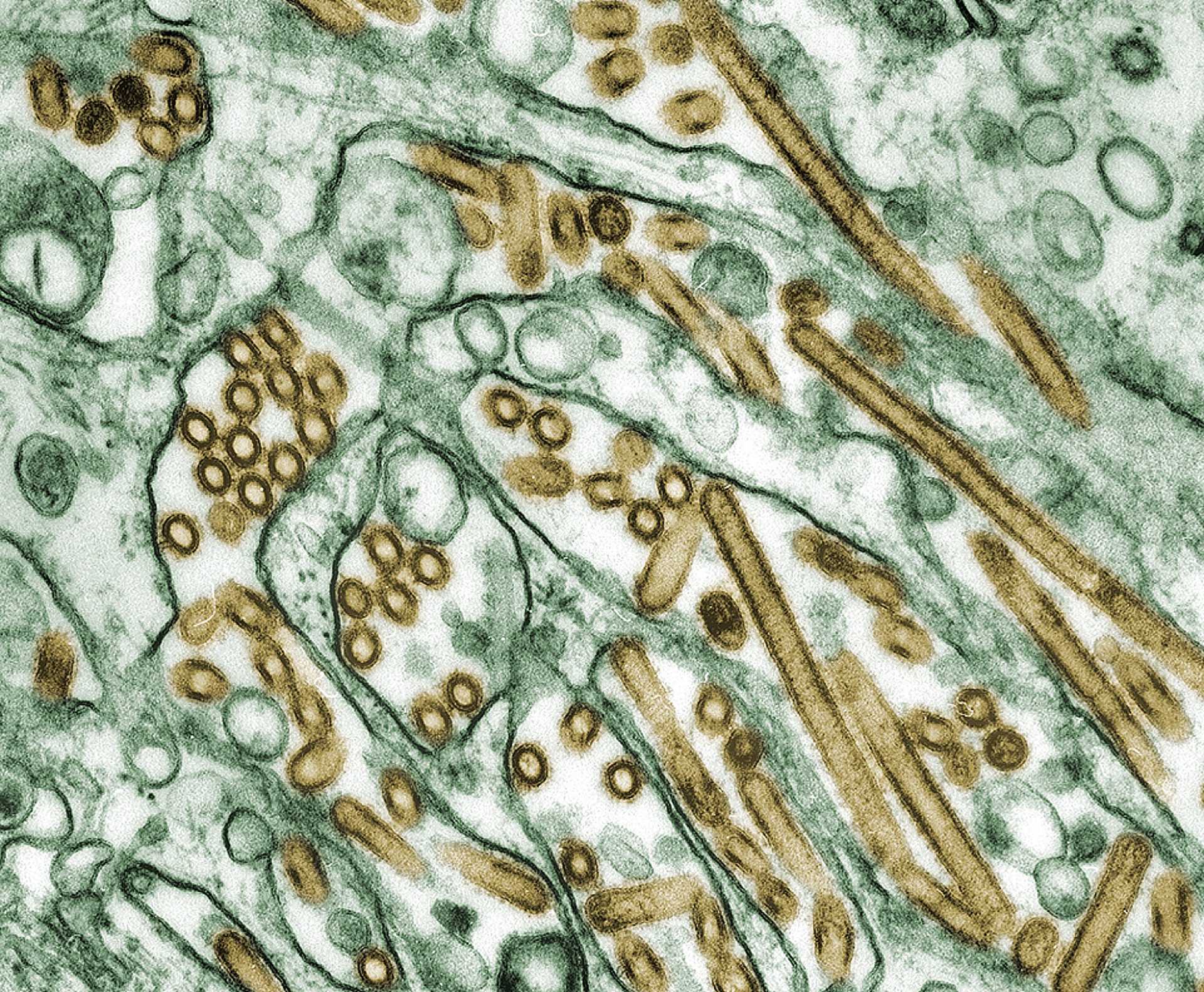 Electron micrograph shows Avian influenza viruses grown in cells. The shape of the viruses vary from dot-like to rod-like.